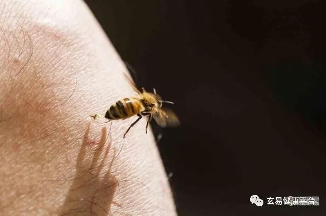 蜂针疗法网络培训班(图1)