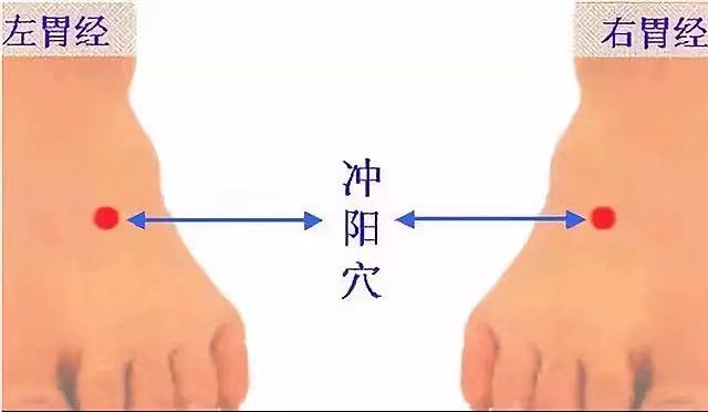 玄易针灸十二图(图4)