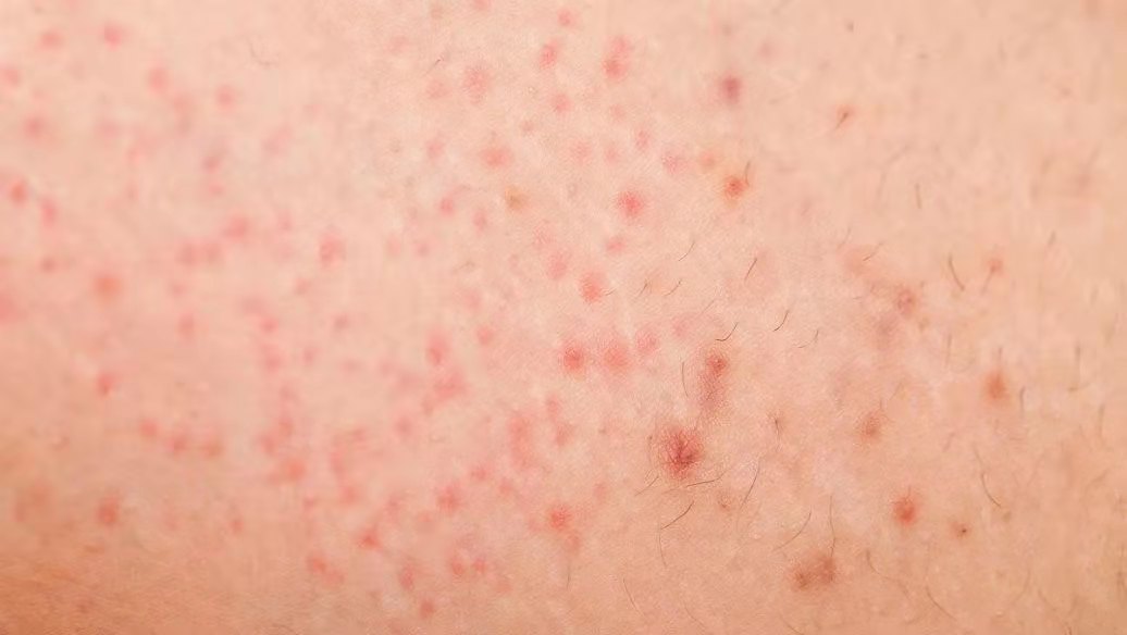 艾叶、艾条、艾灰都是宝,但很多人用错,非常全用的艾清单来咯 艾友圈 昨天  “艾”的这一生,从艾叶到艾条再到艾灰,全都是宝,但都有哪些好处、哪些隐藏用法呢?这篇文章,值得推荐给身边爱(图10) 艾叶、艾条、艾灰都是宝,但很多人用错,非常全用的艾清单来咯 艾友圈 昨天  “艾”的这一生,从艾叶到艾条再到艾灰,全都是宝,但都有哪些好处、哪些隐藏用法呢?这篇文章,值得推荐给身边爱(图10)