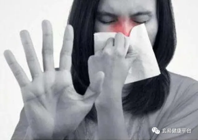 2021伏前灸开启 | 适合冬病夏治的六种病症,千万别错过了!(图7)